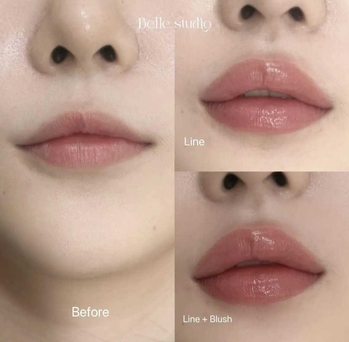 립라인 · 립라인+블러쉬 전후 비교 — 벨스튜디오