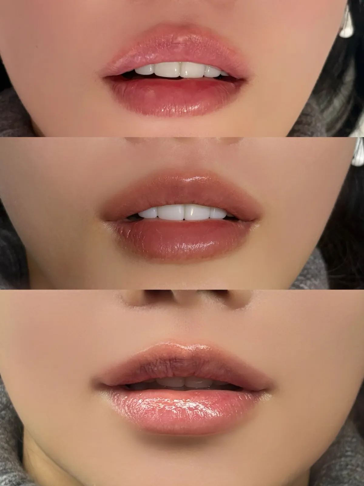 립블러쉬 시술 전 · 직후 · 정착 후 단계별 입술 변화