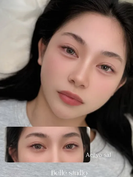 애교살 — 아이 · 눈매 반영구